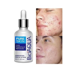 BIOAQUA - Suero Aclarante Y Humectante Facial Anti-acné